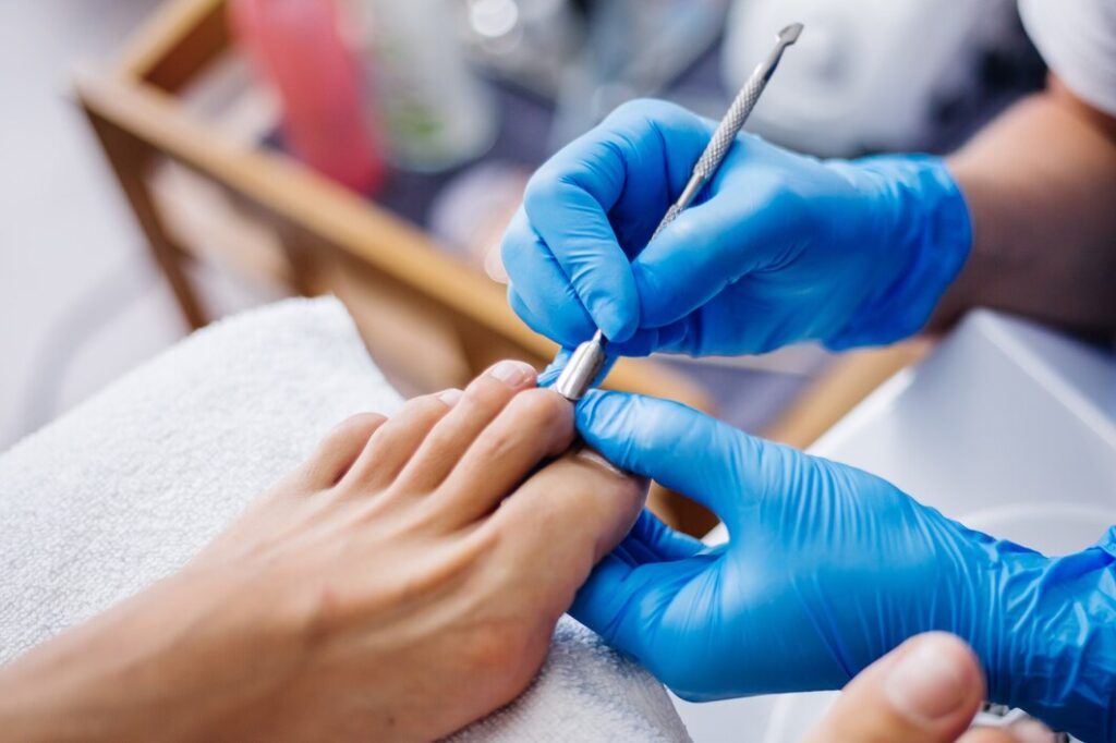 Best Nail Disease Treatments in Secunderabad