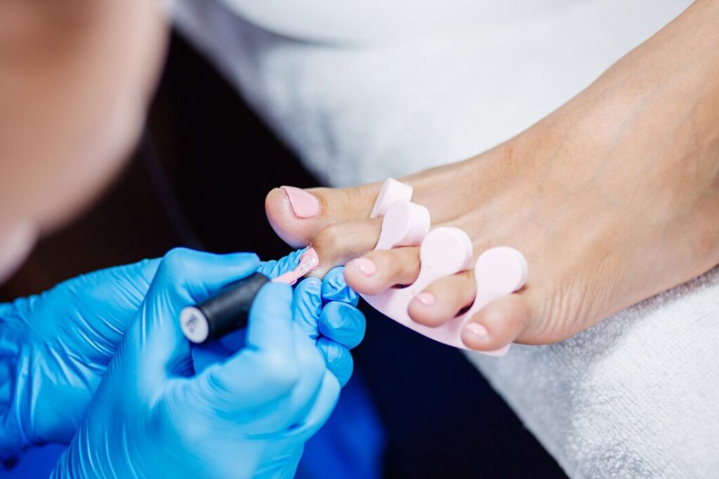 Best Nail Disease Treatments in Secunderabad